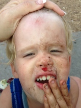 Why toddlers and skateboards don't mix.